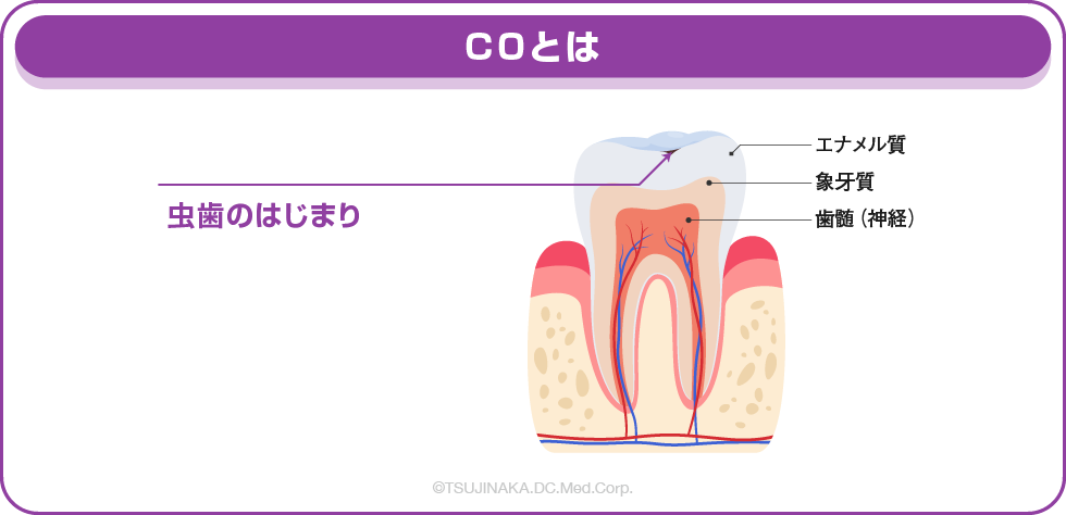 C0とは