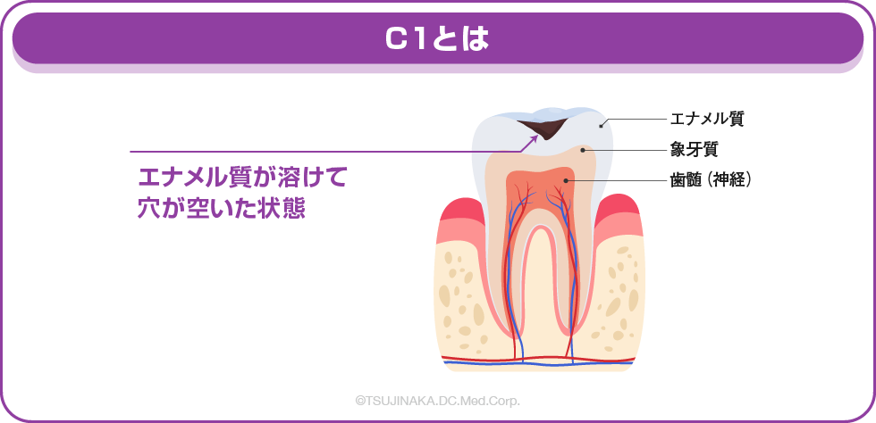 C1とは