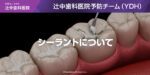 シーラントについて