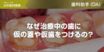 なぜ治療中の歯に仮の蓋や仮歯をつけるの？